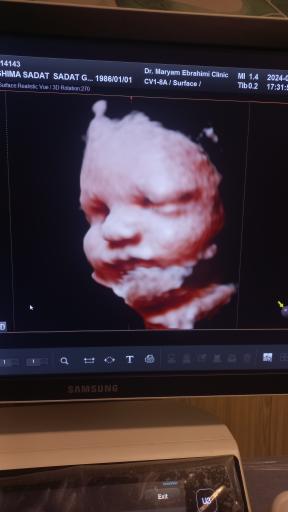 عکس رادیولوژی و سونوگرافی مبنا