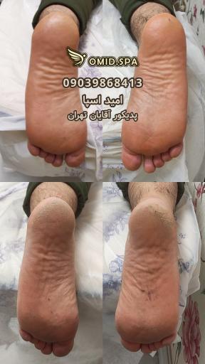عکس مرکز زیبایی و درمانی آقایان تهران امید اسپا