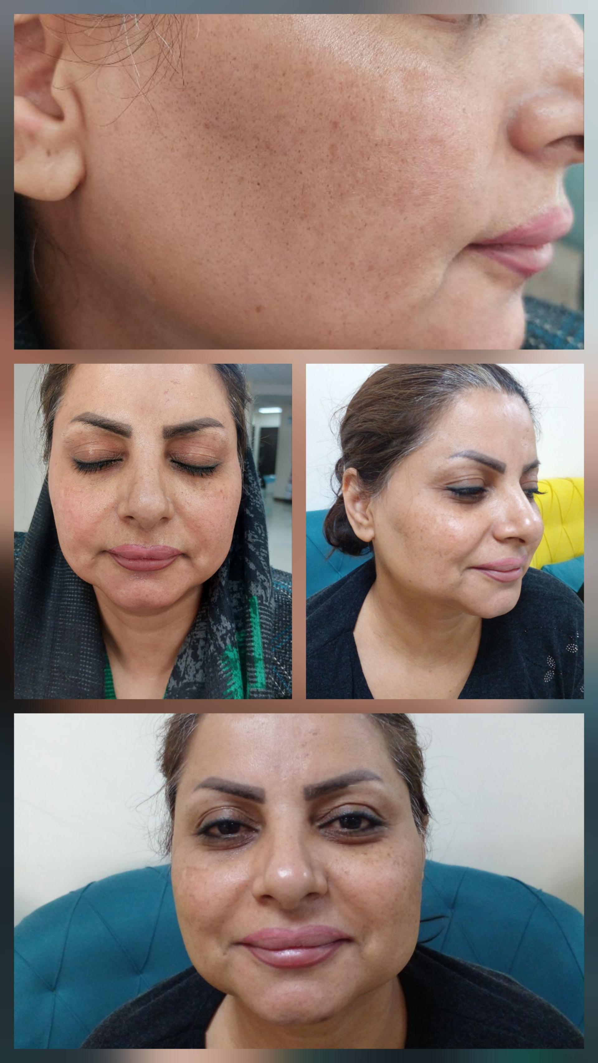 عکس کلینیک لیزر و زیبایی دالیا
