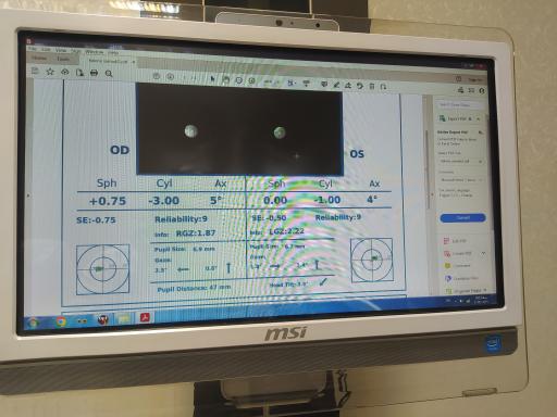 بینایی سنجی و عینک کیمیا