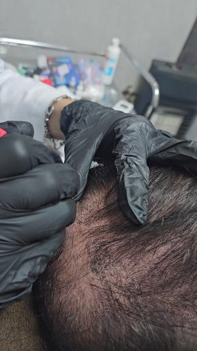 عکس میکرواسکالپ قزوین