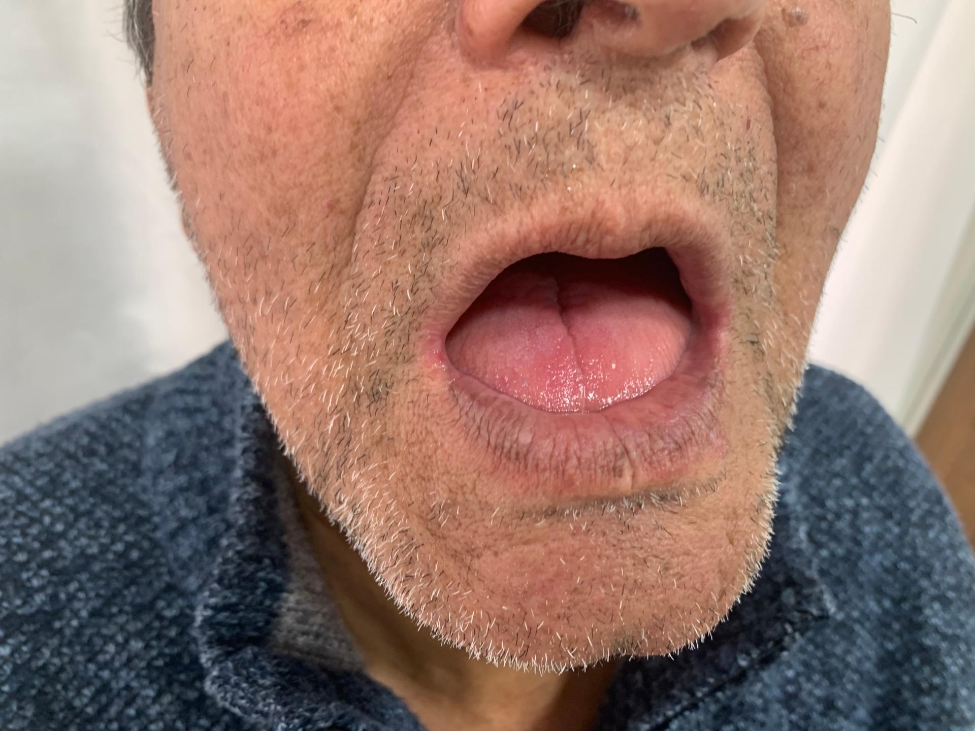 عکس دندانسازی عسگری