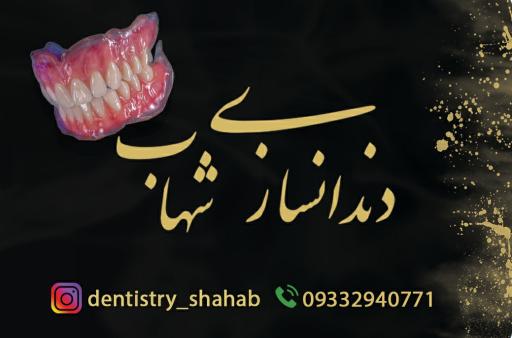 عکس دندانسازی شهاب دیهیمیان