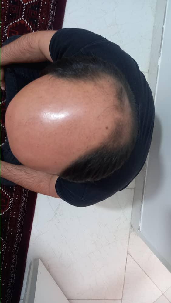 عکس مرکز زیبایی نگین گرگان