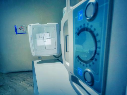 عکس رادیولوژی، سونوگرافی و OPG مادر