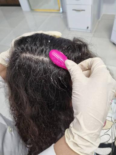 سالن زیبایی اسکالپ زرنگار