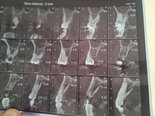 عکس رادیولوژی فک و صورت دکتر الهام مرادی