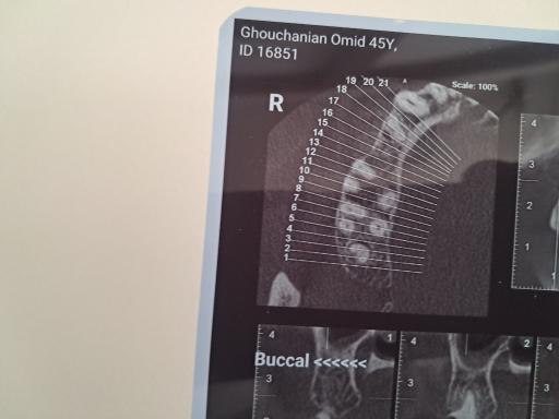 عکس رادیولوژی فک و صورت دکتر الهام مرادی