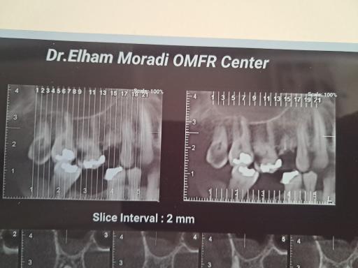 عکس رادیولوژی فک و صورت دکتر الهام مرادی