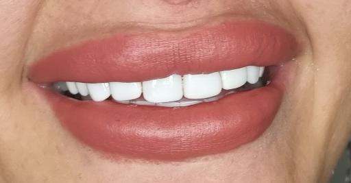 عکس دکتر مجید غلامی جراح دندانپزشک زیبایی ایمپلنت