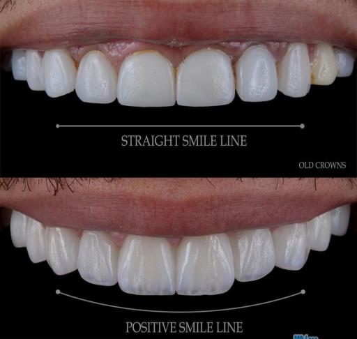 عکس دکتر مجید غلامی جراح دندانپزشک زیبایی ایمپلنت