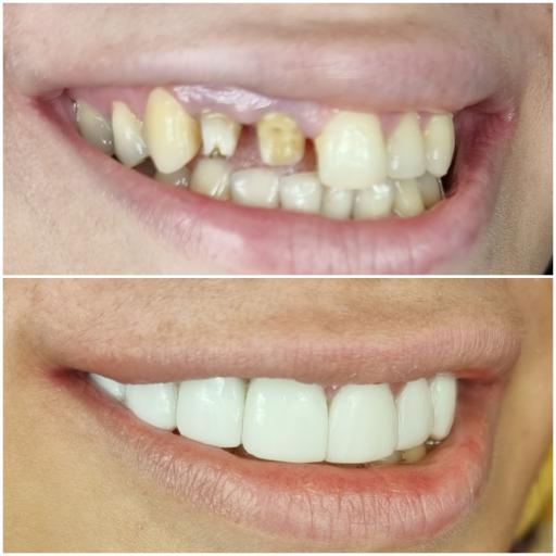 عکس دکتر مجید غلامی جراح دندانپزشک زیبایی ایمپلنت