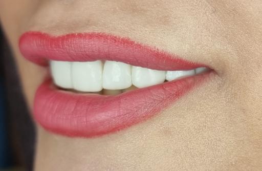 عکس دکتر مجید غلامی جراح دندانپزشک زیبایی ایمپلنت