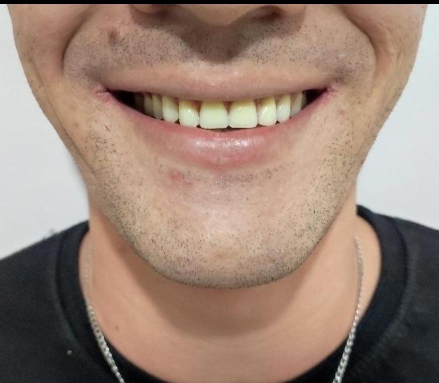 عکس دندانسازی کدخدا