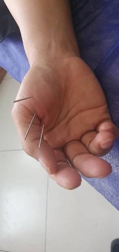 عکس مطب طب سنتی و طب سوزنی دکتر مرتضی ترابی