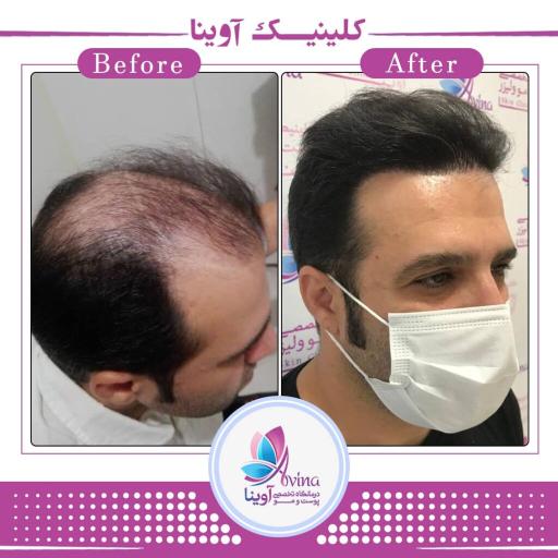 عکس کلینیک پوست و مو آوینا