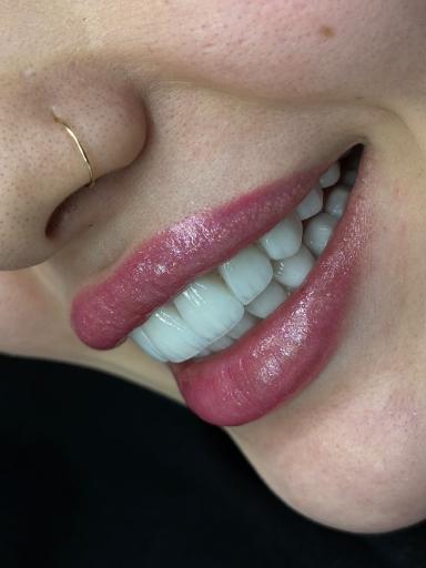عکس دندانپزشکی حس