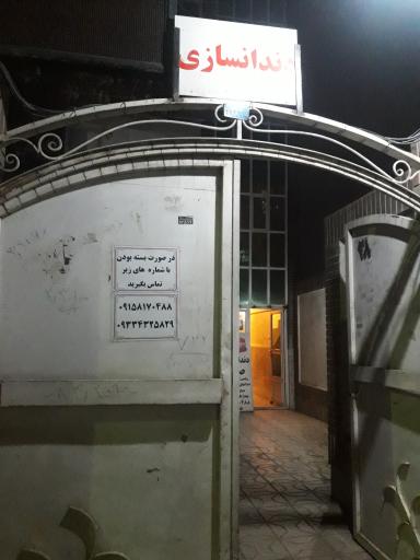 عکس دندانسازی صدف 