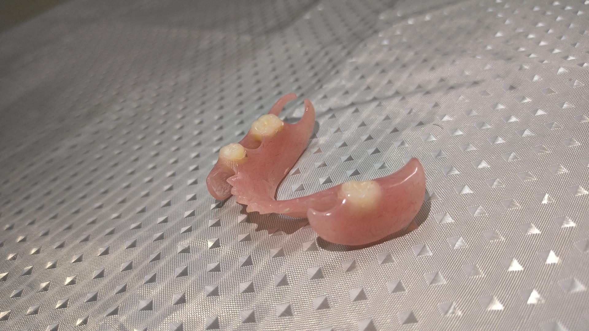 عکس دندانسازی پارس