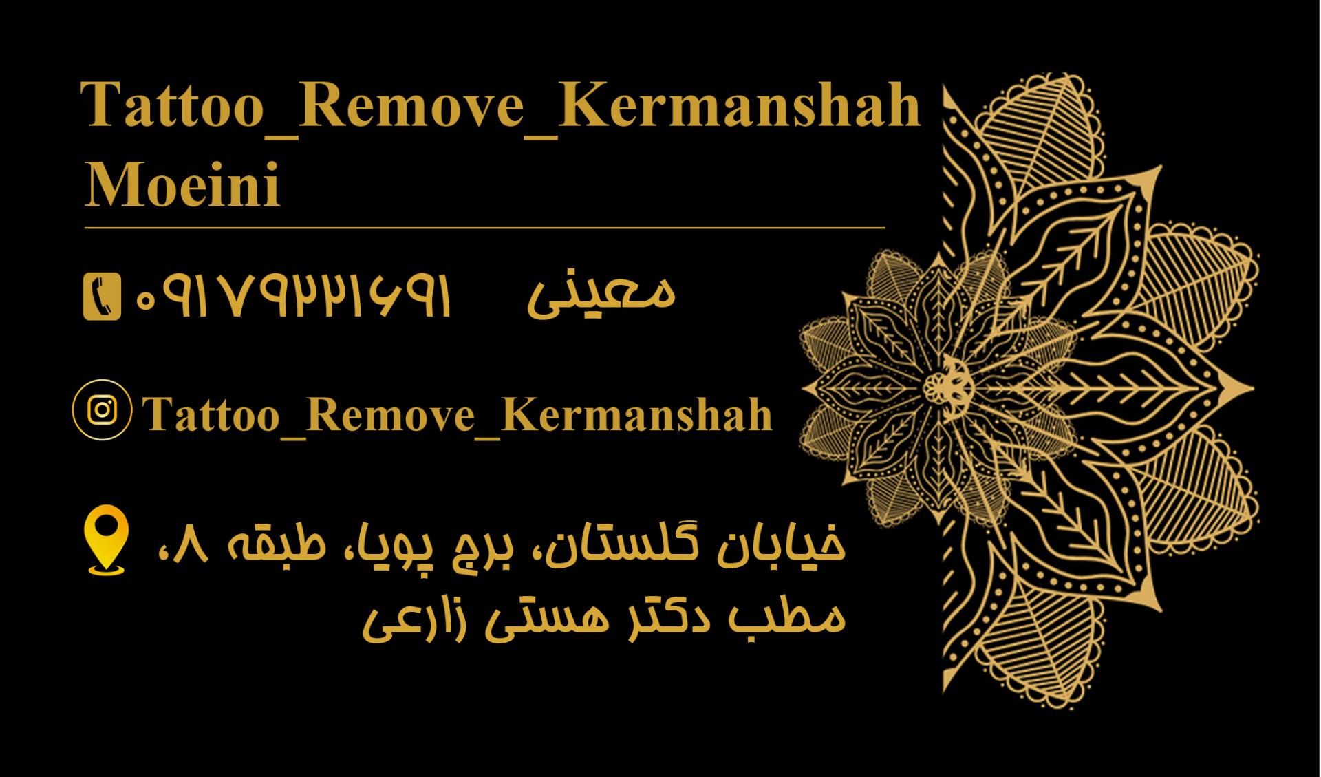 عکس مرکز ریمو تتو کرمانشاه