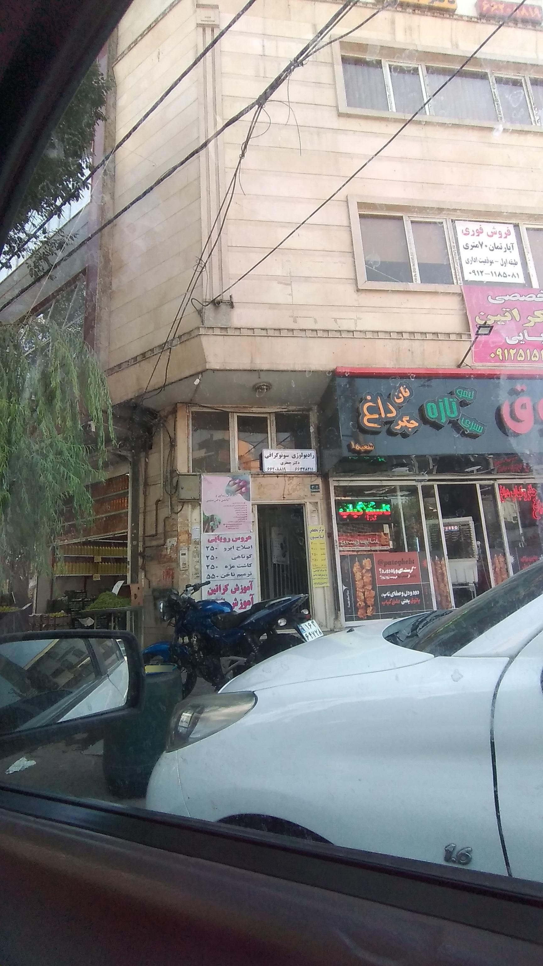 عکس سونوگرافی رادیولوژی دکتر جعفری