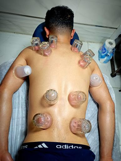 عکس خدمات ماساژ درمانی و حجامت درمانی شامحمدی