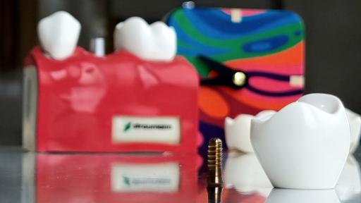 کلینیک تخصصی و فوق تخصصی ایمپلنت تبریز