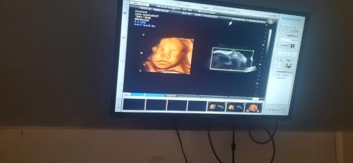عکس سونوگرافی تخصصی دکتر مشیریان