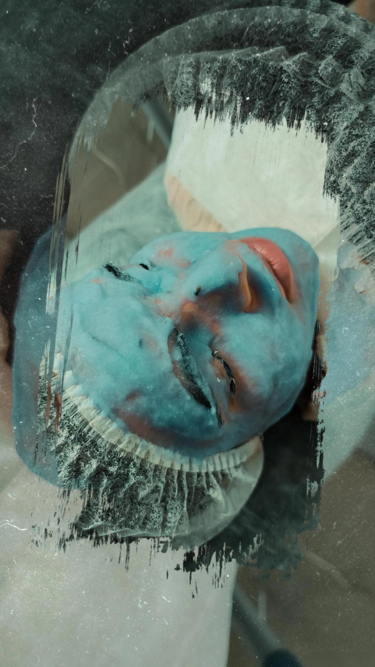 عکس فیشیال و پاکسازی اتاق پوست آزیتا