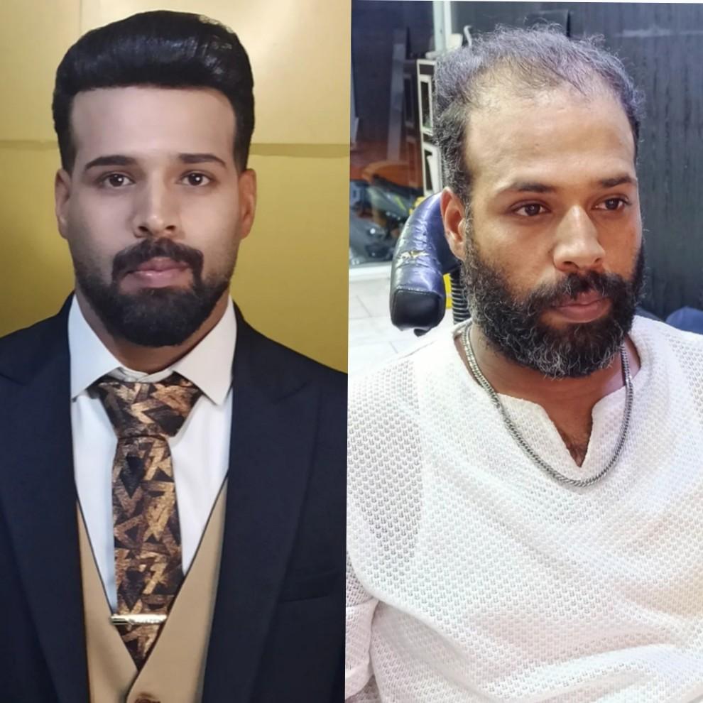 عکس سالن تخصصی داماد کاشت موقت مو و اموزش ارایشگری