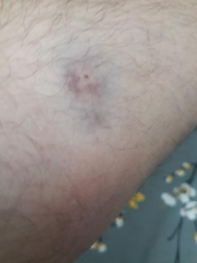 عکس سازمان انتقال خون بابلسر