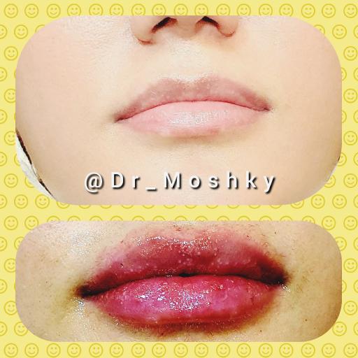 عکس مرکز تخصصی پوست و لیزر و زیبایی (دکتر حمید مشکی)