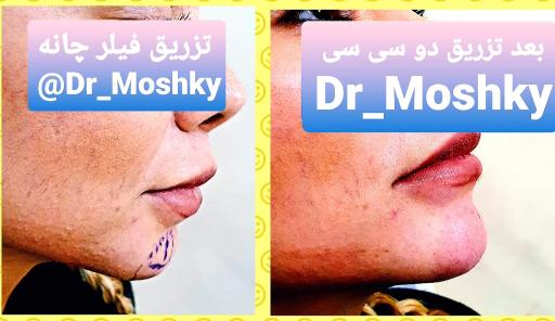 عکس مرکز تخصصی پوست و لیزر و زیبایی (دکتر حمید مشکی)