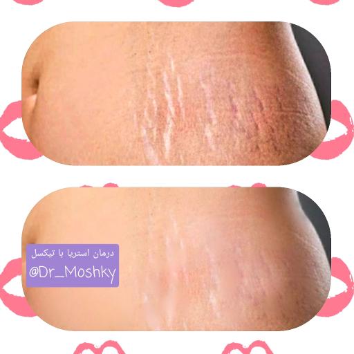 عکس مرکز تخصصی پوست و لیزر و زیبایی (دکتر حمید مشکی)