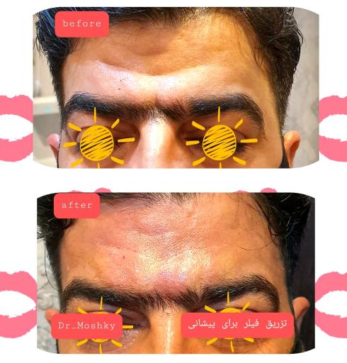 عکس مرکز تخصصی پوست و لیزر و زیبایی (دکتر حمید مشکی)