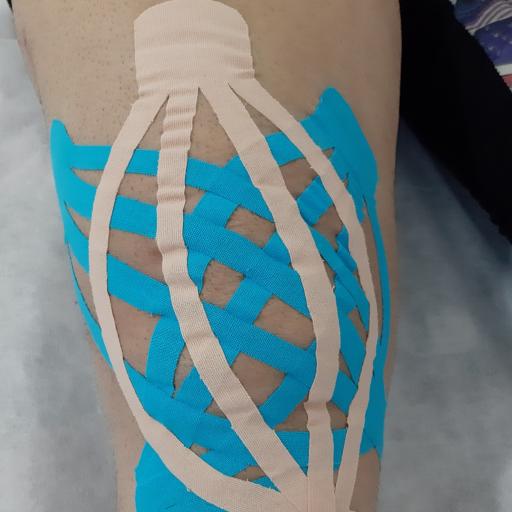 عکس فیزیوتراپی ایرانمهر 