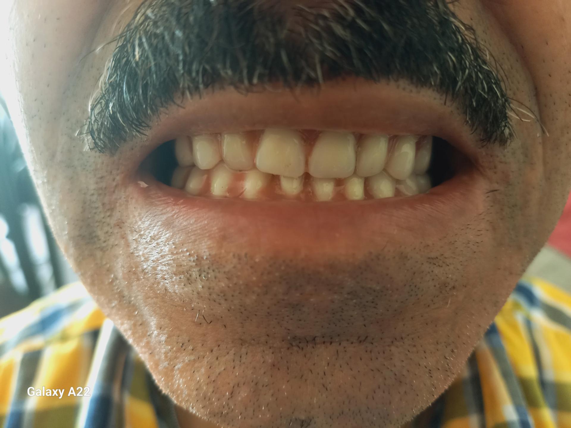 عکس دندانسازی شاکری