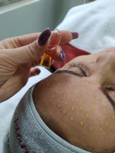 عکس پاکسازی صورت و فشیال تکتم رئوف