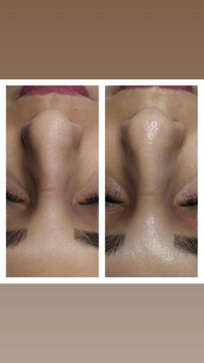 عکس پاکسازی و فشیال تکتم رئوف