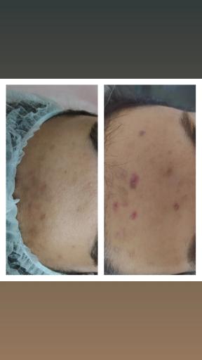 عکس پاکسازی و فشیال تکتم رئوف