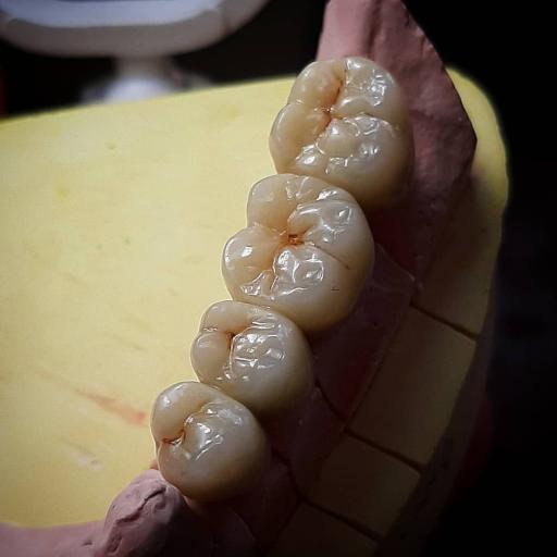 عکس لابراتوار تخصصی پروتزهای دندانی احسان فعلی