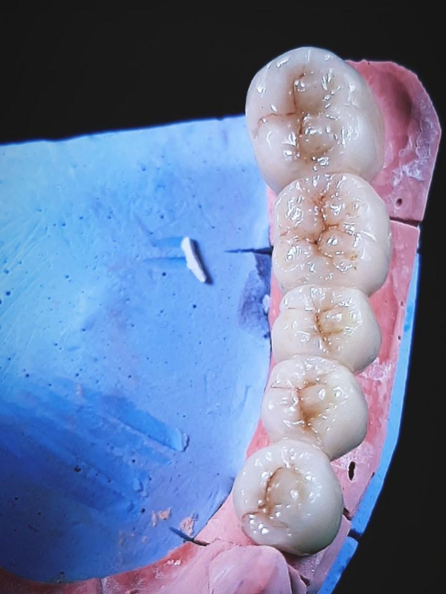 عکس لابراتوار تخصصی پروتزهای دندانی احسان فعلی