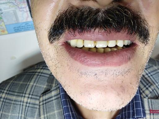 عکس لابراتوار دندانسازی ثامن