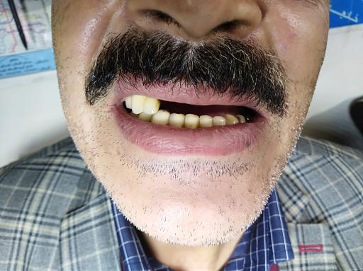 عکس لابراتوار دندانسازی ثامن