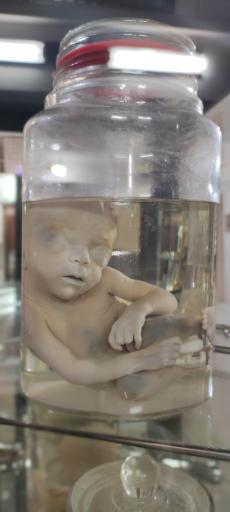 عکس موزه تاریخ پزشکی خلیج فارس