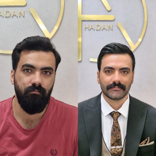 عکس آرایشگاه پیرایش مردانه داماد هادان