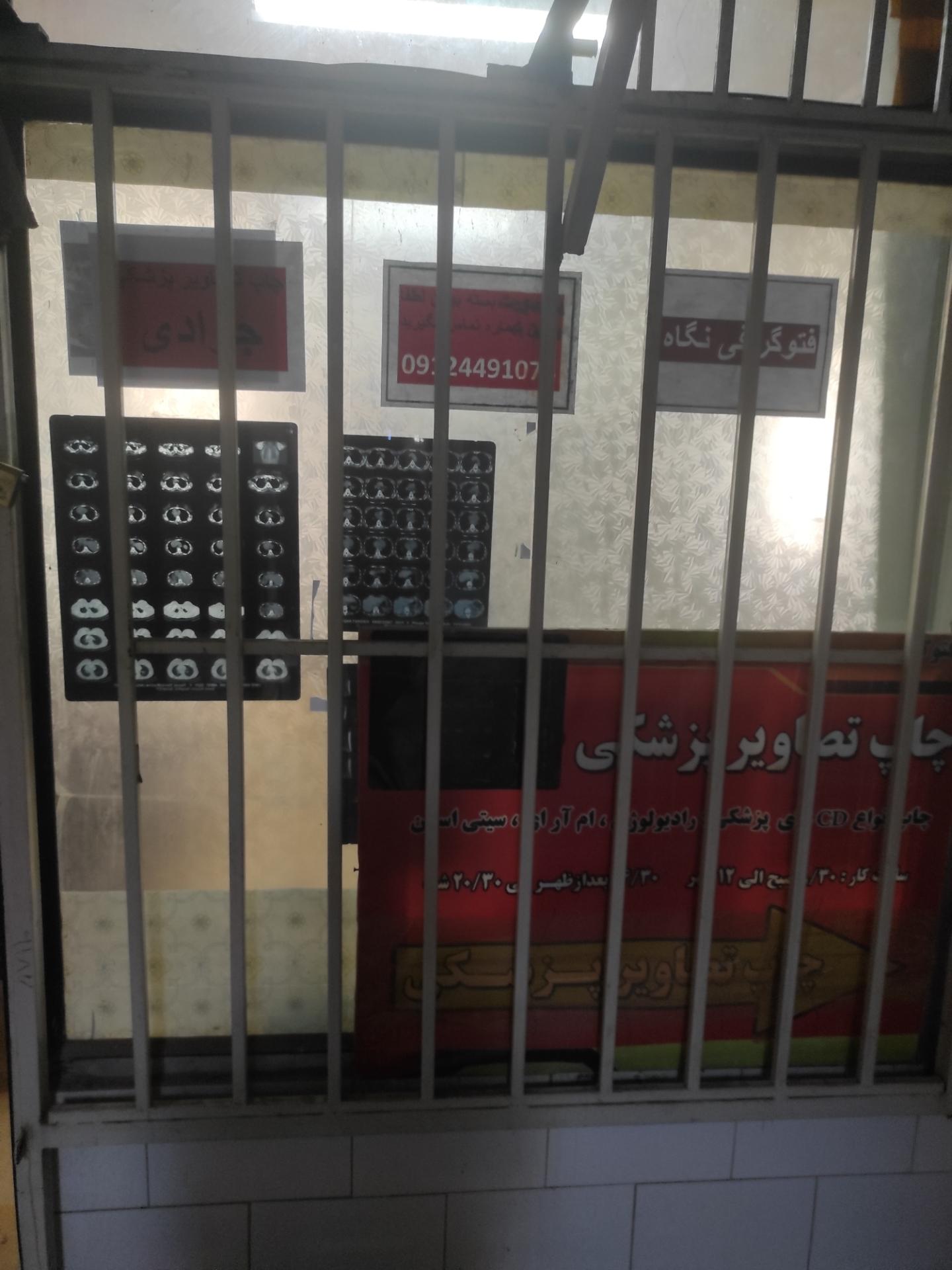 عکس فوتو نگاه(چاپ cd های MRI و ...)