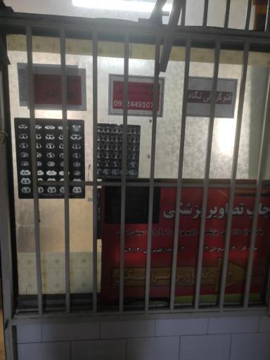 عکس فوتو نگاه(چاپ cd های MRI و ...)