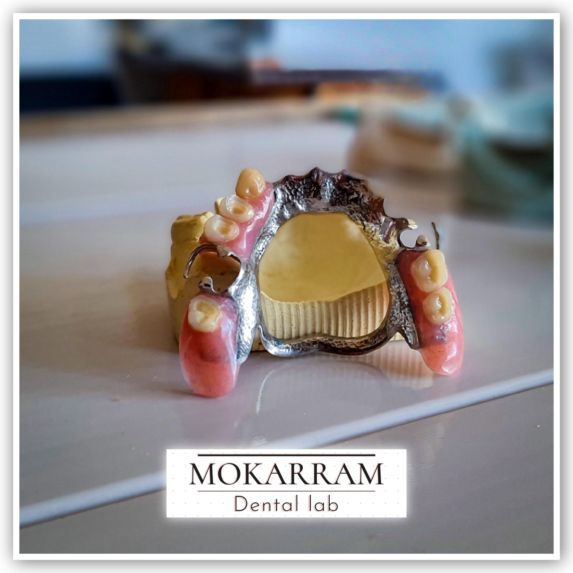 عکس دندانسازی مکرم