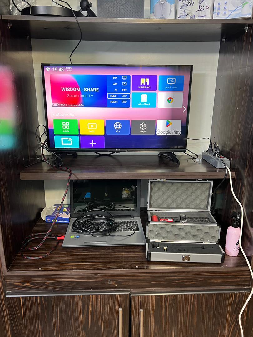 عکس استروبوسکوپی (عکس برداری از حنجره) تهران